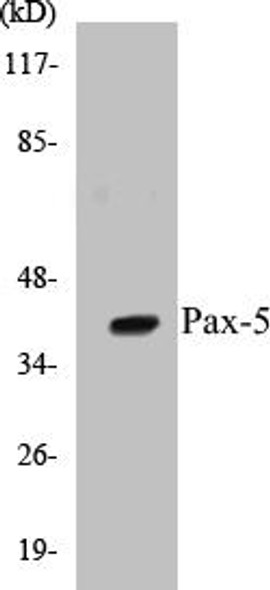 Pax-5 Colorimetric Cell-Based ELISA Kit
