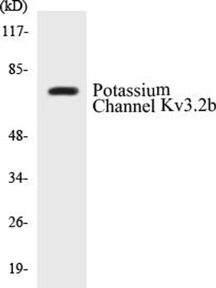 Potassium Channel Kv3.2b Colorimetric Cell-Based ELISA Kit