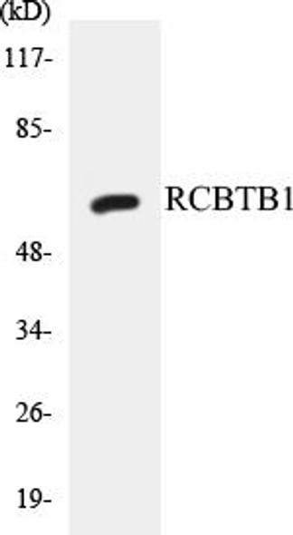 RCBTB1 Colorimetric Cell-Based ELISA Kit