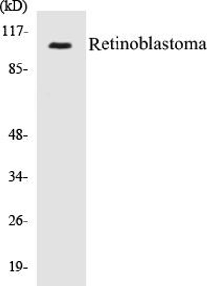 Retinoblastoma Colorimetric Cell-Based ELISA Kit