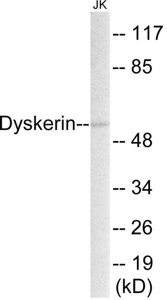 Dyskerin Colorimetric Cell-Based ELISA