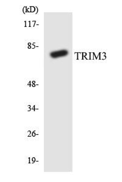 TRIM3 Colorimetric Cell-Based ELISA