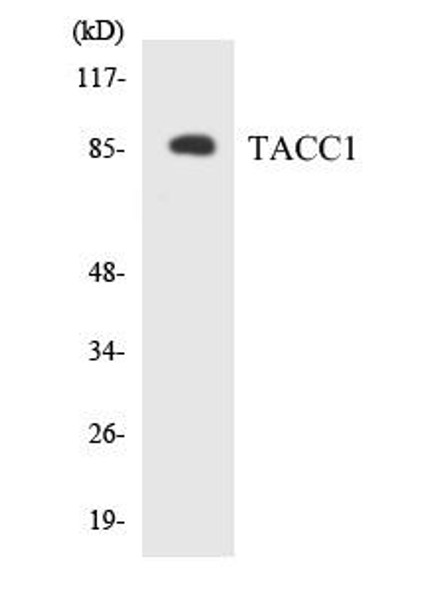 TACC1 Colorimetric Cell-Based ELISA