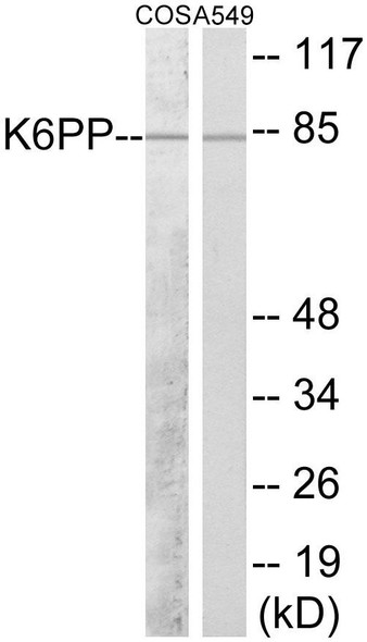 K6PP Colorimetric Cell-Based ELISA