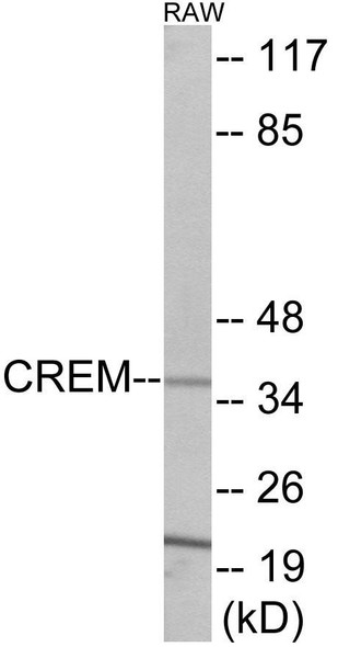 CREM Colorimetric Cell-Based ELISA