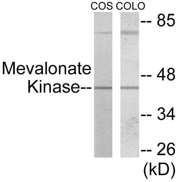 Mevalonate Kinase Colorimetric Cell-Based ELISA
