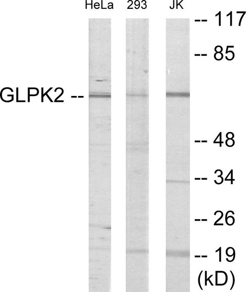 GK2 Colorimetric Cell-Based ELISA