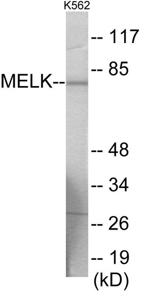 MELK Colorimetric Cell-Based ELISA