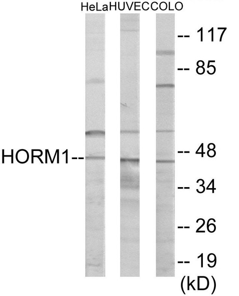 HORMAD1 Colorimetric Cell-Based ELISA