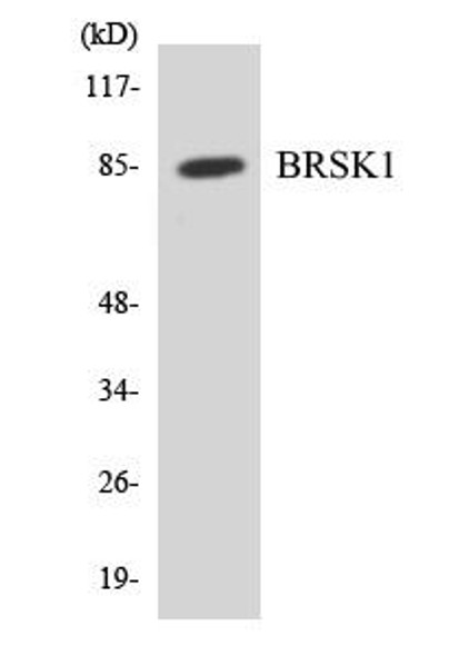 BRSK1 Colorimetric Cell-Based ELISA