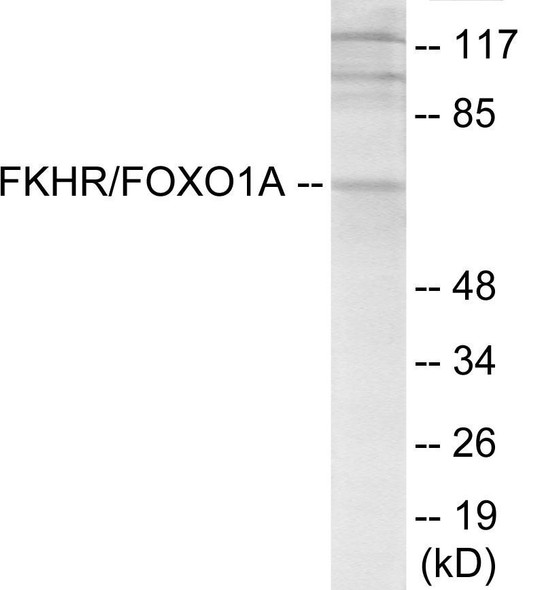 FKHR Colorimetric Cell-Based ELISA