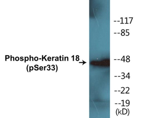 Keratin 18 (Phospho-Ser33) Colorimetric Cell-Based ELISA Kit