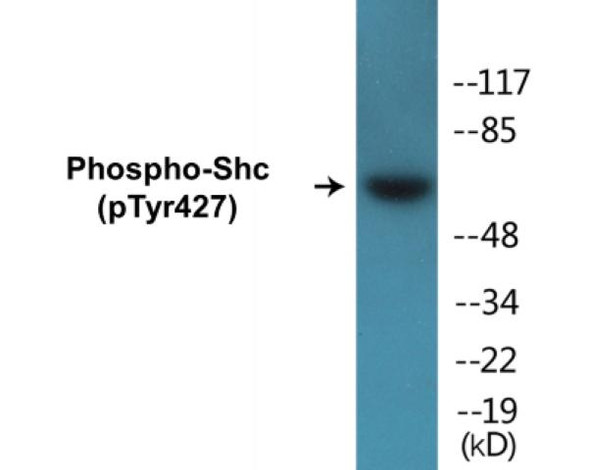 Shc (Phospho-Tyr427) Colorimetric Cell-Based ELISA Kit