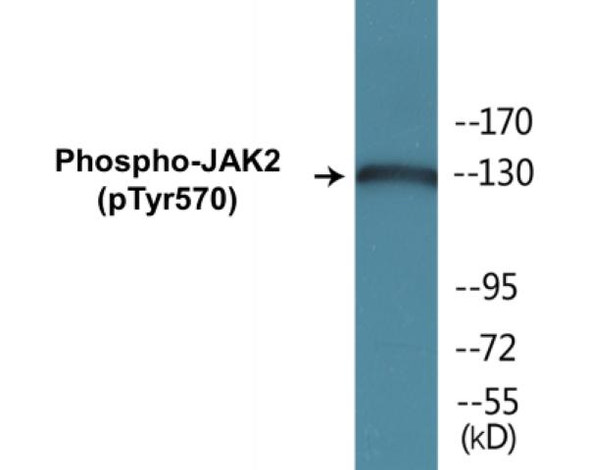 JAK2 (Phospho-Tyr570) Colorimetric Cell-Based ELISA Kit