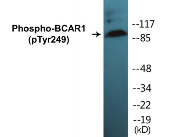 BCAR1 (Phospho-Tyr249) Colorimetric Cell-Based ELISA Kit