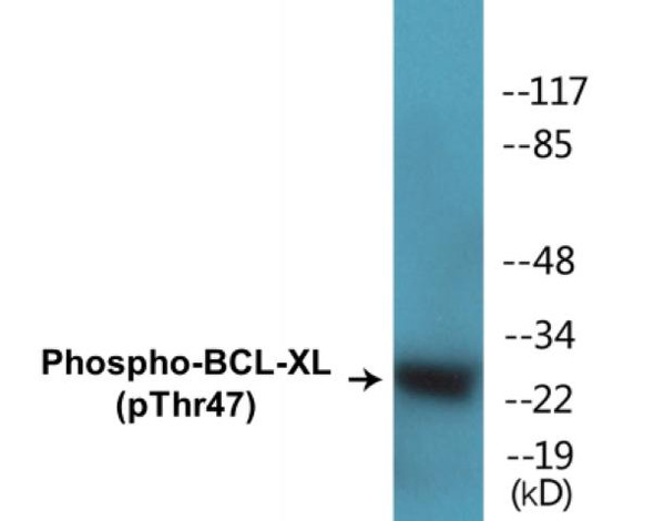 BCL-XL (Phospho-Thr47) Colorimetric Cell-Based ELISA Kit