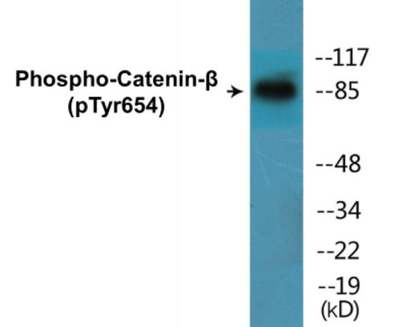 Catenin-beta (Phospho-Tyr654) Colorimetric Cell-Based ELISA Kit