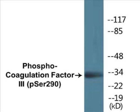 Coagulation Factor III (Phospho-Ser290) Colorimetric Cell-Based ELISA Kit