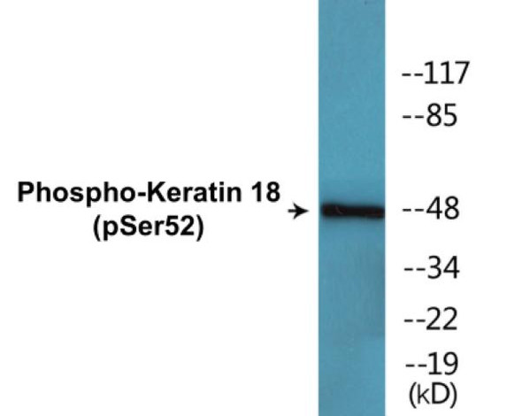 Keratin 18 (Phospho-Ser52) Colorimetric Cell-Based ELISA Kit