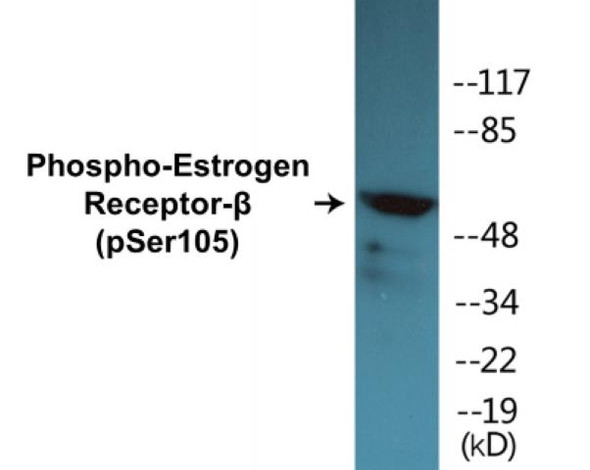 Estrogen Receptor-beta (Phospho-Ser105) Colorimetric Cell-Based ELISA Kit