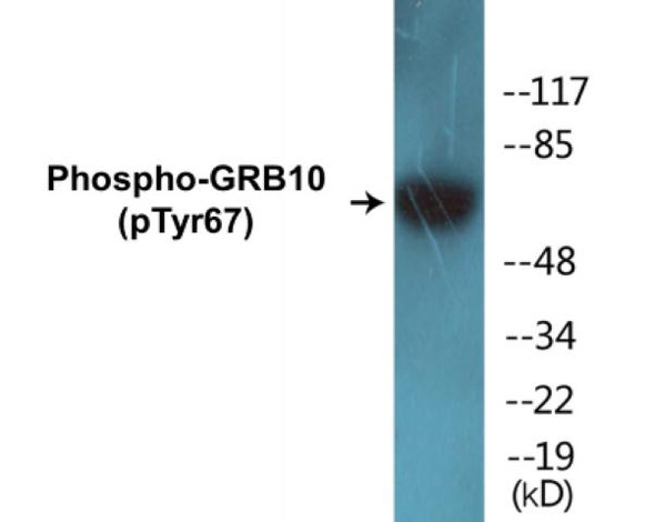 GRB10 (Phospho-Tyr67) Colorimetric Cell-Based ELISA Kit