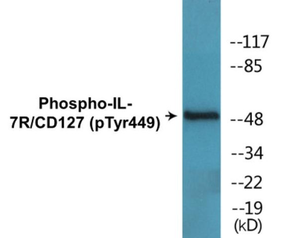 IL-7R/CD127 (Phospho-Tyr449) Colorimetric Cell-Based ELISA Kit
