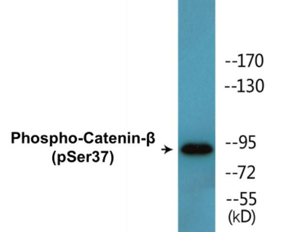 Catenin-beta (Phospho-Ser37) Colorimetric Cell-Based ELISA Kit