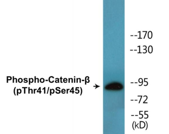 Catenin-beta (Phospho-Thr41/Ser45) Colorimetric Cell-Based ELISA Kit