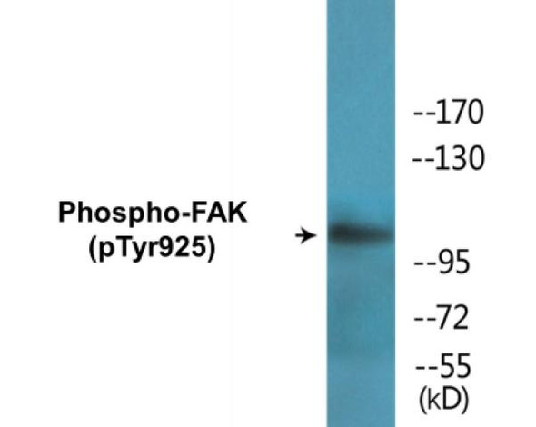 FAK (Phospho-Tyr925) Colorimetric Cell-Based ELISA Kit