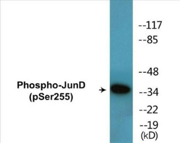 JunD (Phospho-Ser255) Colorimetric Cell-Based ELISA Kit