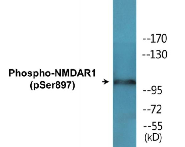 NMDAR1 (Phospho-Ser897) Colorimetric Cell-Based ELISA Kit