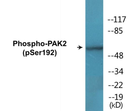 PAK2 (Phospho-Ser192) Colorimetric Cell-Based ELISA Kit