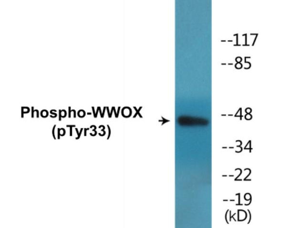 WWOX (Phospho-Tyr33) Colorimetric Cell-Based ELISA Kit