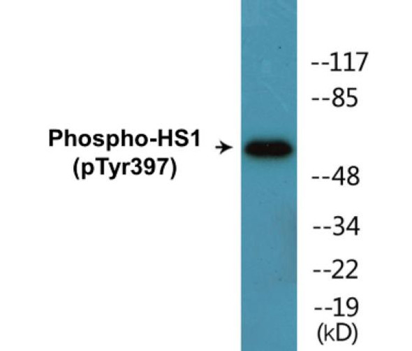 HS1 (Phospho-Tyr397) Colorimetric Cell-Based ELISA Kit