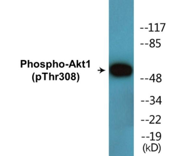 Akt1 (Phospho-Thr308) Colorimetric Cell-Based ELISA Kit