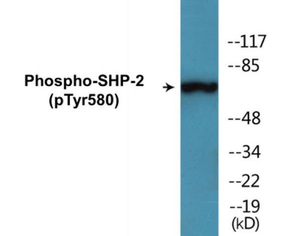 SHP-2 (Phospho-Tyr580) Fluorometric Cell-Based ELISA Kit
