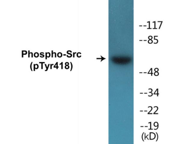 Src (Phospho-Tyr418) Fluorometric Cell-Based ELISA Kit