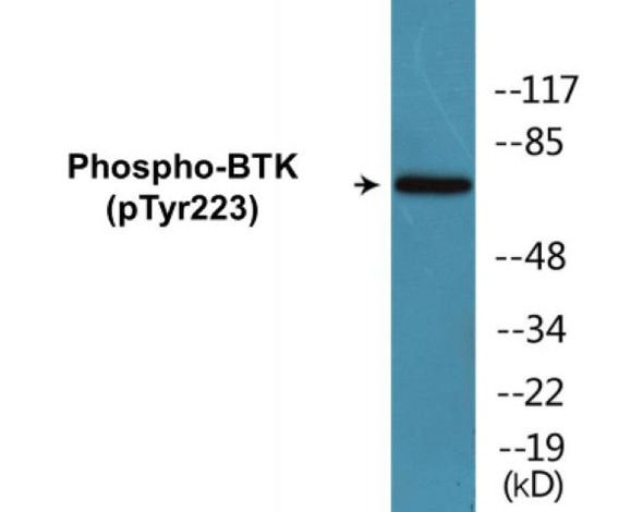 BTK (Phospho-Tyr223) Fluorometric Cell-Based ELISA Kit