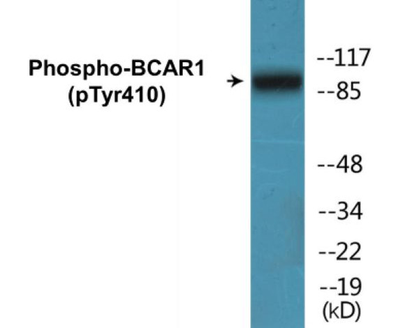 BCAR1 (Phospho-Tyr410) Fluorometric Cell-Based ELISA Kit