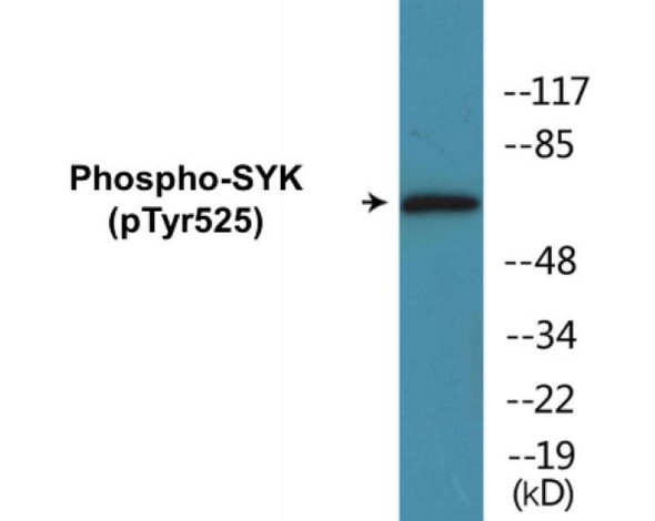 SYK (Phospho-Tyr525) Fluorometric Cell-Based ELISA Kit