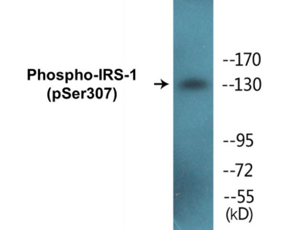 IRS-1 (Phospho-Ser307) Fluorometric Cell-Based ELISA Kit