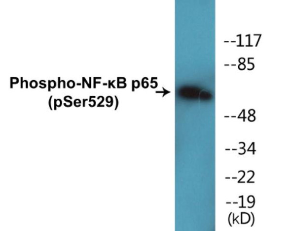 NF-kB p65 (Phospho-Ser529) Fluorometric Cell-Based ELISA Kit
