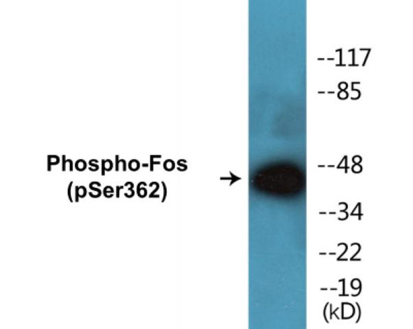 Fos (Phospho-Ser362) Fluorometric Cell-Based ELISA Kit