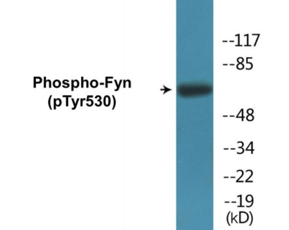 Fyn (Phospho-Tyr530) Fluorometric Cell-Based ELISA Kit