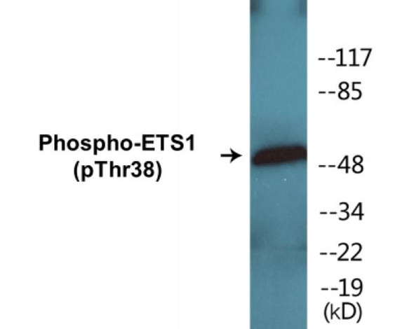 ETS1 (Phospho-Thr38) Fluorometric Cell-Based ELISA Kit