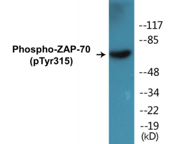 ZAP-70 (Phospho-Tyr315) Fluorometric Cell-Based ELISA Kit