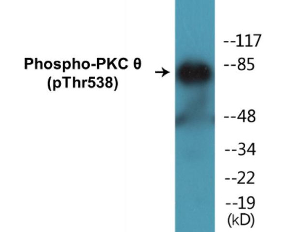 PKC theta (Phospho-Thr538) Fluorometric Cell-Based ELISA Kit