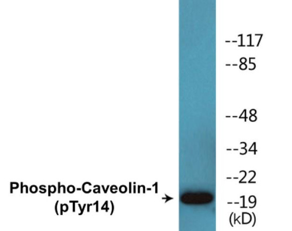 Caveolin-1 (Phospho-Tyr14) Fluorometric Cell-Based ELISA Kit