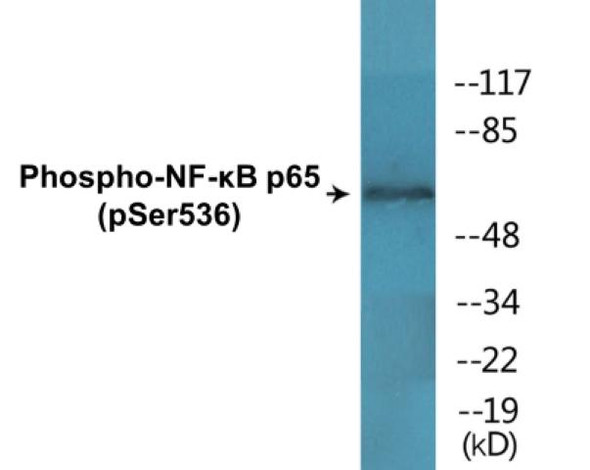 NF-kB p65 (Phospho-Ser536) Fluorometric Cell-Based ELISA Kit