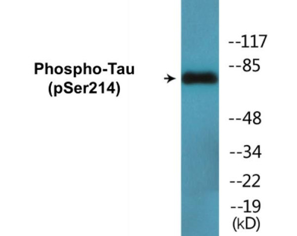 Tau (Phospho-Ser214) Fluorometric Cell-Based ELISA Kit